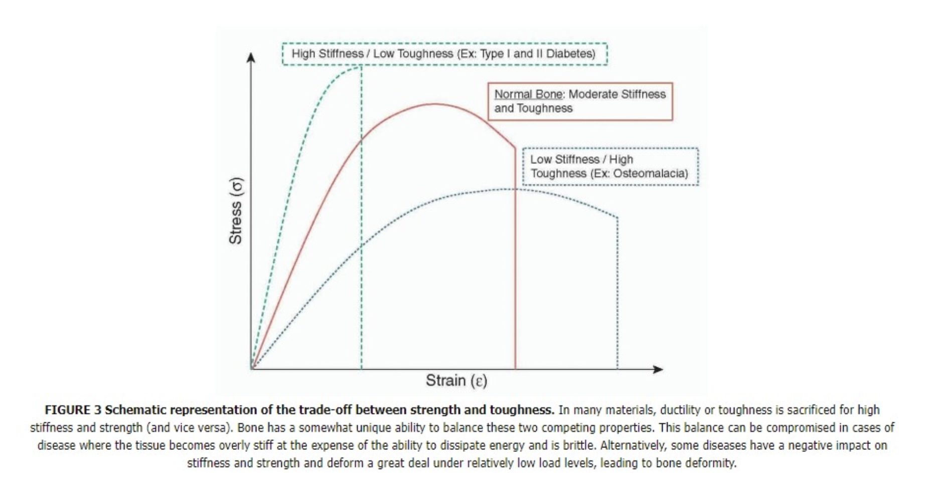 Medial Tibial Stress Syndrome (MTSS)